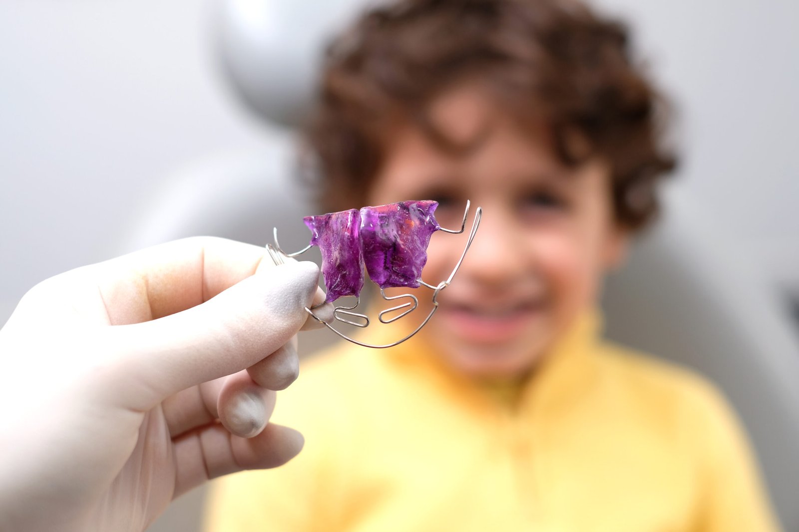Aparelho Ortodôntico Infantil: importância do tratamento precoce